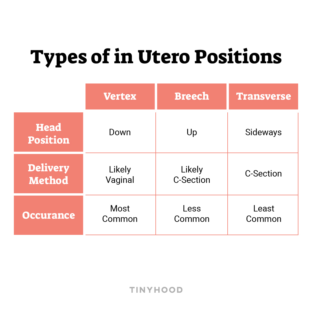 Vertex Position Fetal Position In