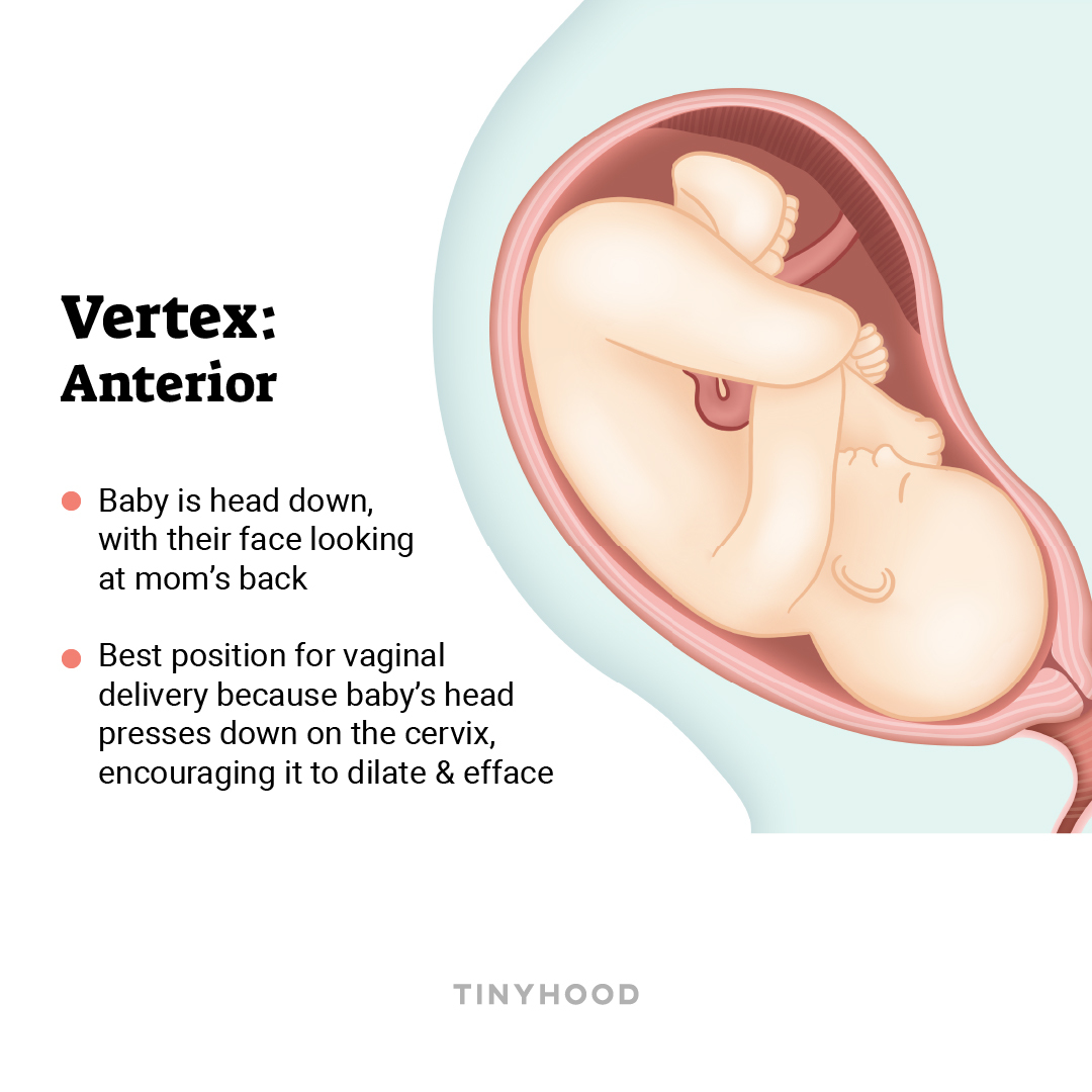 vertex presentation birth meaning